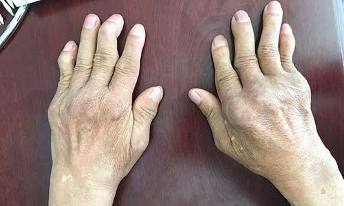 科普丨您知道什么是晨僵吗