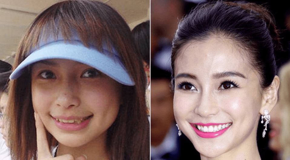 《且听凤鸣》开播,杨超越颜值在线,演技在线吗?_牙齿