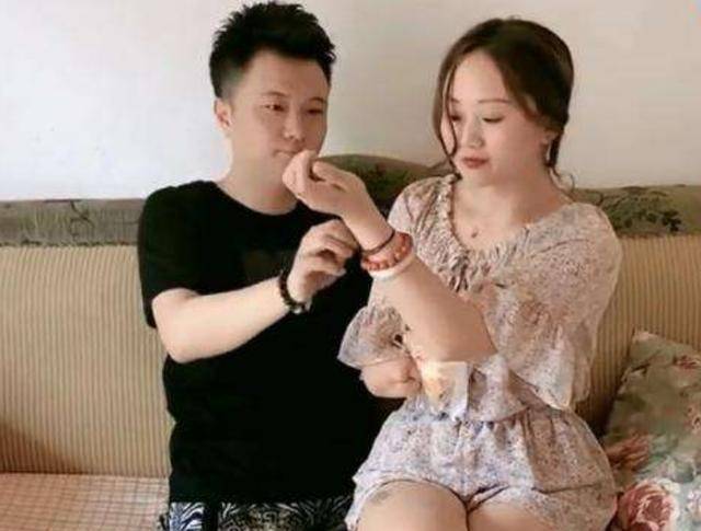 当年轰动一时的连体夫妻曾离不开彼此如今也终被现实打败