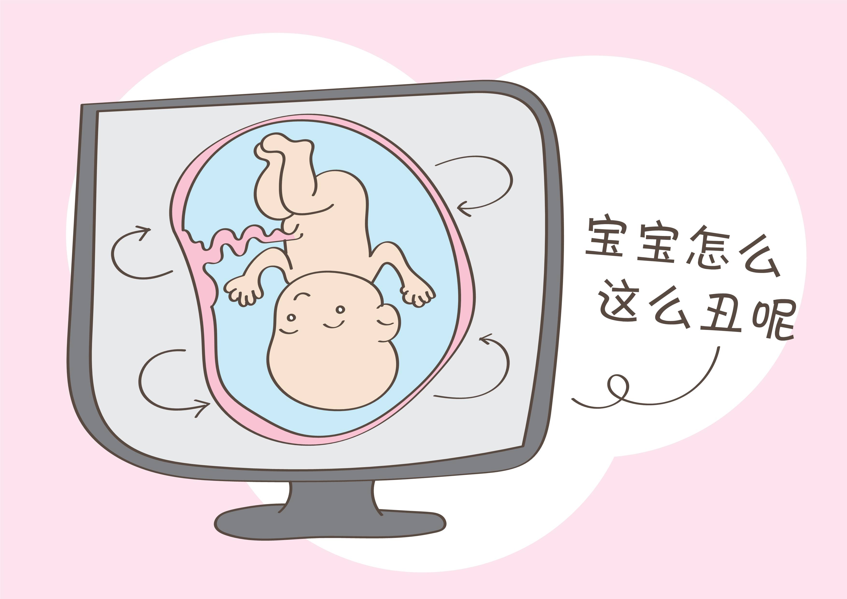 四维彩超发现胎儿太丑,宝妈哭得让人心碎,直男宝爸劝慰方式沦陷