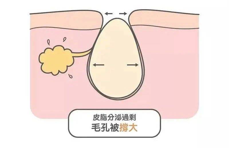 护肤常识毛孔大作战有哪些收缩毛孔的好方法