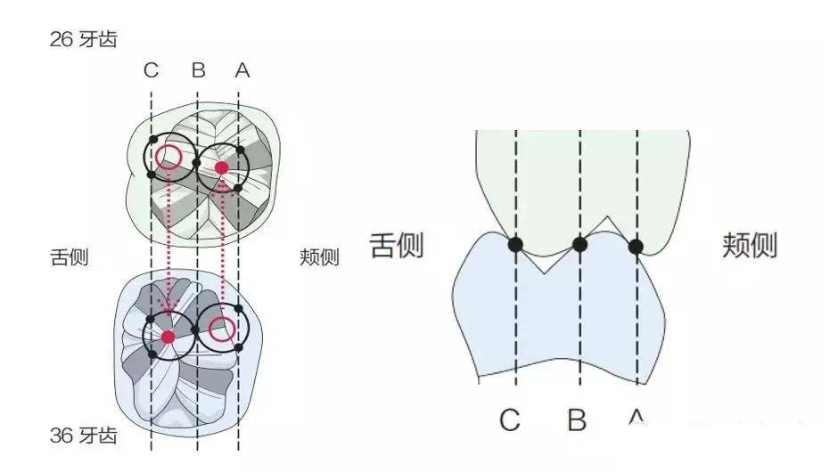 牙齿邻面接触点位置图片