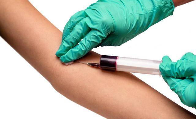 原创抽血测血脂这5个因素可能会让结果撒谎别上当了