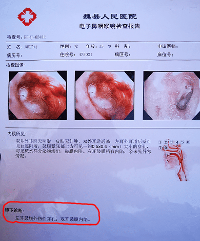 邯郸一女生校外遭同学围殴狂扇耳光!医院诊断为耳膜穿孔