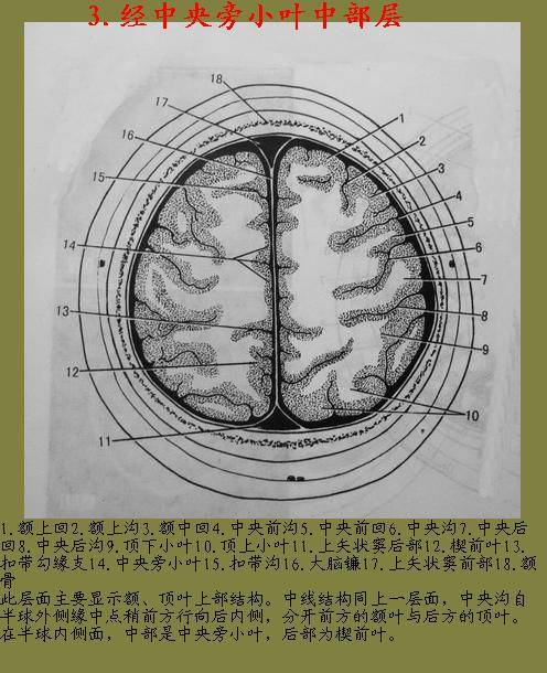 頭部橫斷層解剖圖譜線條圖