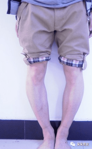 太细随之而来的是腿型也容易暴露,罗圈腿,内外八,一眼就看得出来你