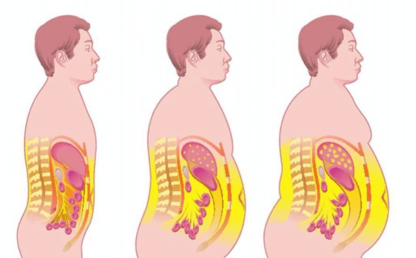 什么是内脏脂肪?只有对症下"药,减脂才能成功!