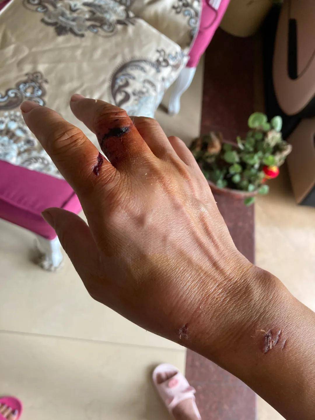 泰州某小区内恶犬出没咬人咬狗嚣张跋扈