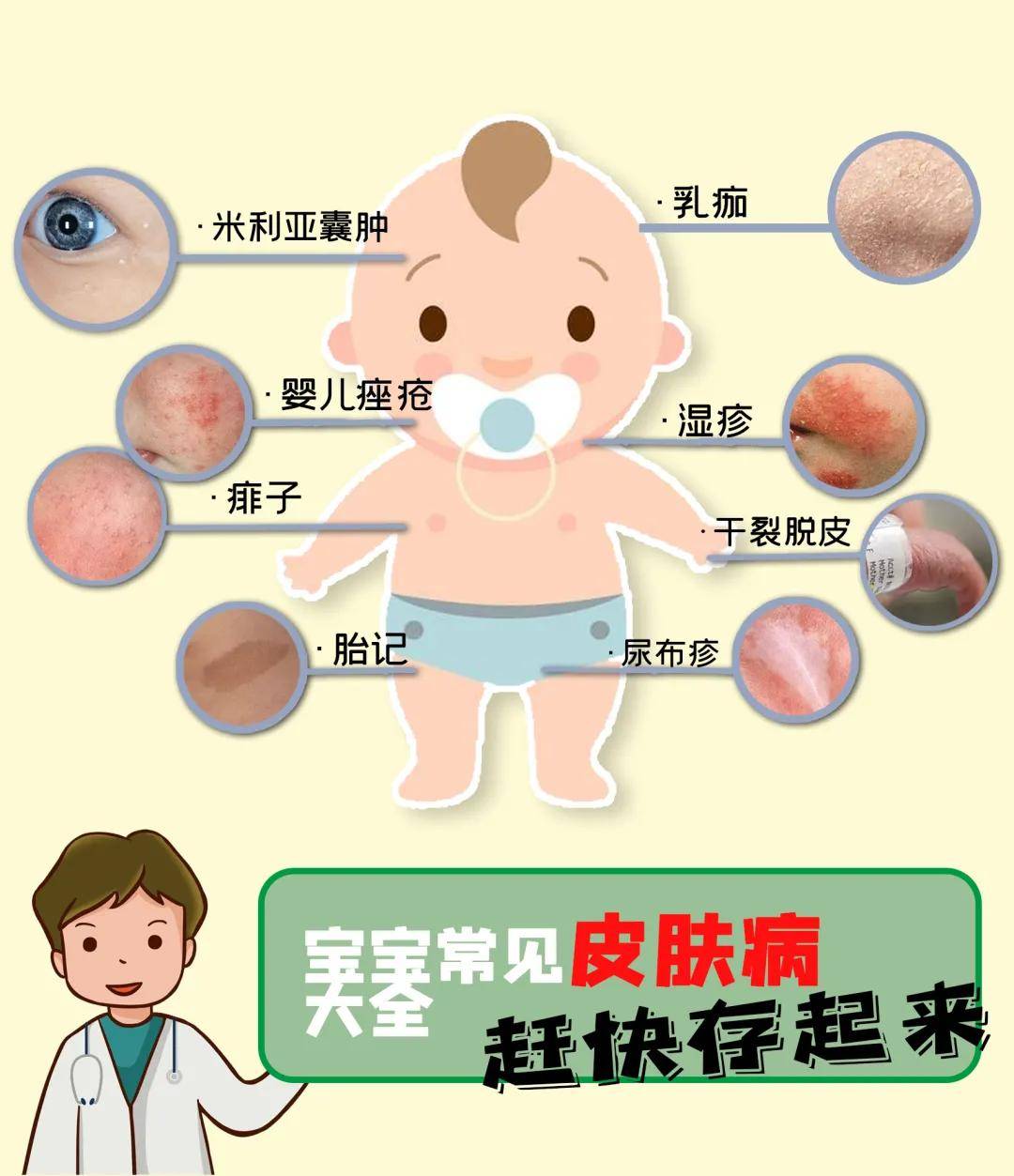 婴儿常见皮肤病对照图图片