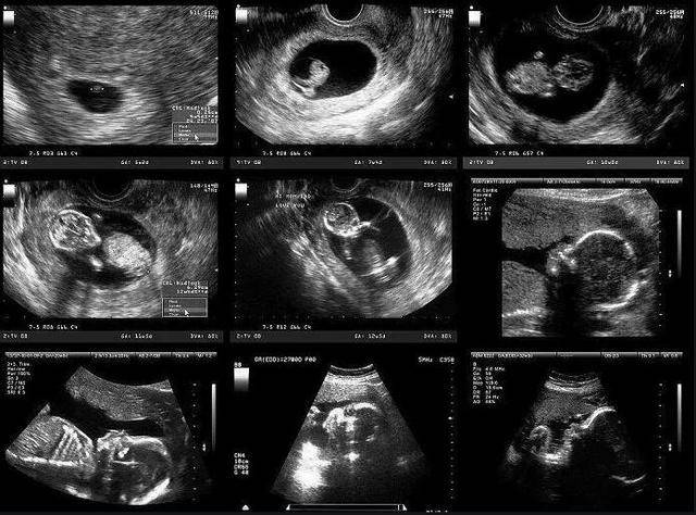 孕期最后一个月,孕妇遵循三做二不做,胎儿出生更顺利