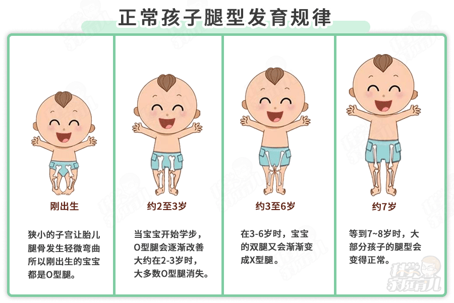 宝宝腿型发育标准图片图片
