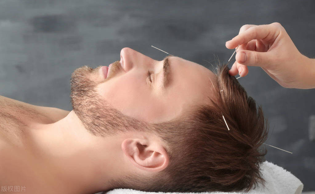 今天讲下针刺穴位治疗头痛处方,这个内容有点难了,特别是外行的_手机