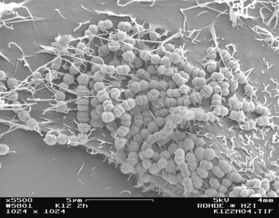 扫描电镜下的唾液链球菌k12blis k1264 是全新种类的益生菌,由一种