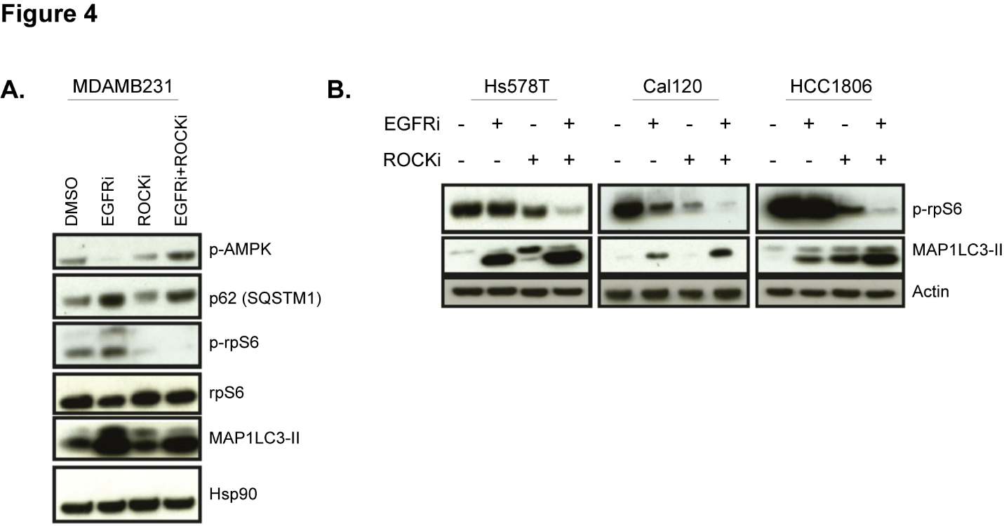 细胞自噬流分析培养hs578t细胞,分别使用egfri和egfr rocki抑制剂进行