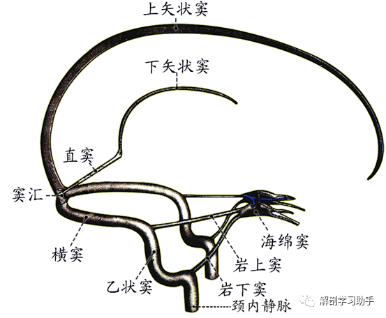 乙状窦解剖位置图图片