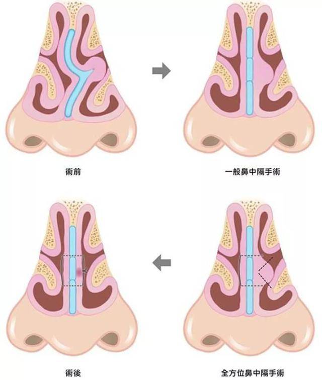 除了感冒,原来还有这些情况会造成鼻塞_手机搜狐网