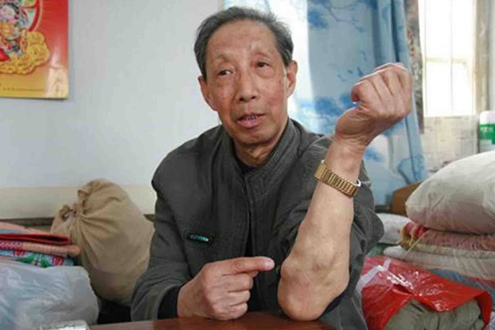 总是长脂肪瘤是什么原因?你知道吗,教你1方从根上解决