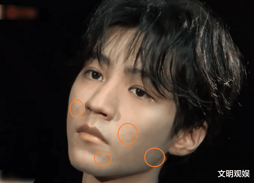 王俊凯百花奖后台拍摄在高清怼脸拍镜头下脸部状态过于真实