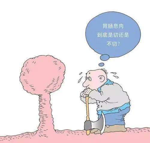 你不了解的胃息肉