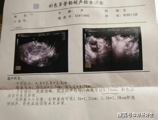 卵泡不破裂没有卵子排出怎么办?