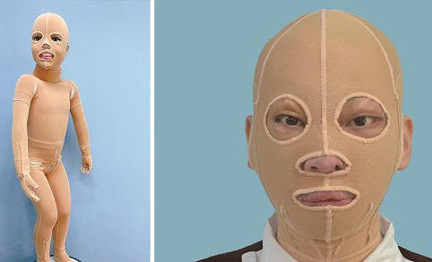 烧伤医用弹力衣压力衣用什么料?_手机搜狐网