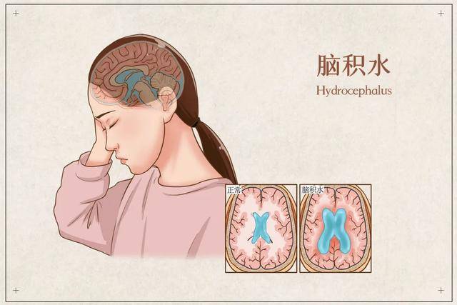 当有人骂"你脑壳里头是不是有水",都给我这样怼回去!