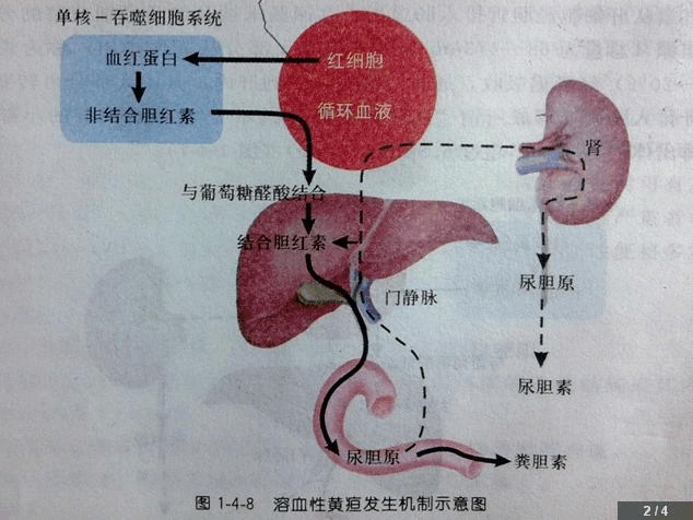 成年人也会得黄疸吗?黄疸到底是怎么回事?是什么原因造成的?_治疗