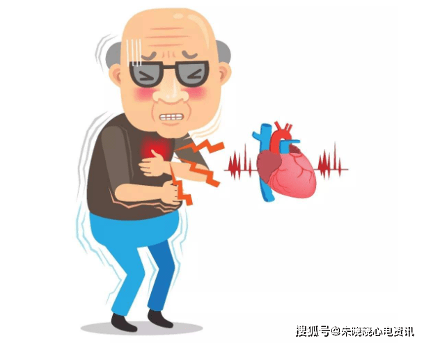 房颤患者用药误区必须要知道