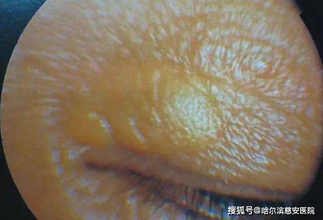 哈尔滨慈安医院乐大医学慈安医院