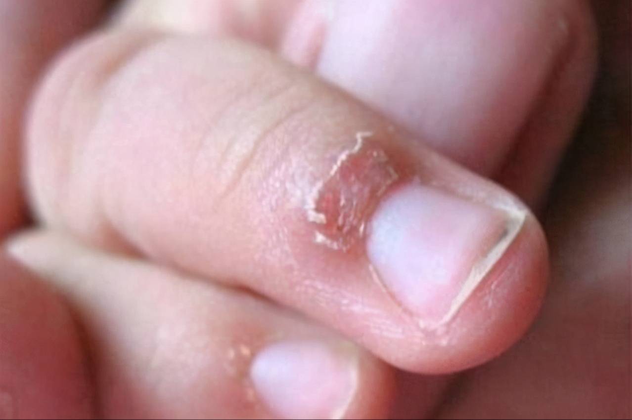 原创老人说"娃手上起倒刺是营养不良",真正原因有3点,不要小看