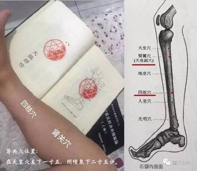 史继霞董氏奇穴肾关穴,四肢穴