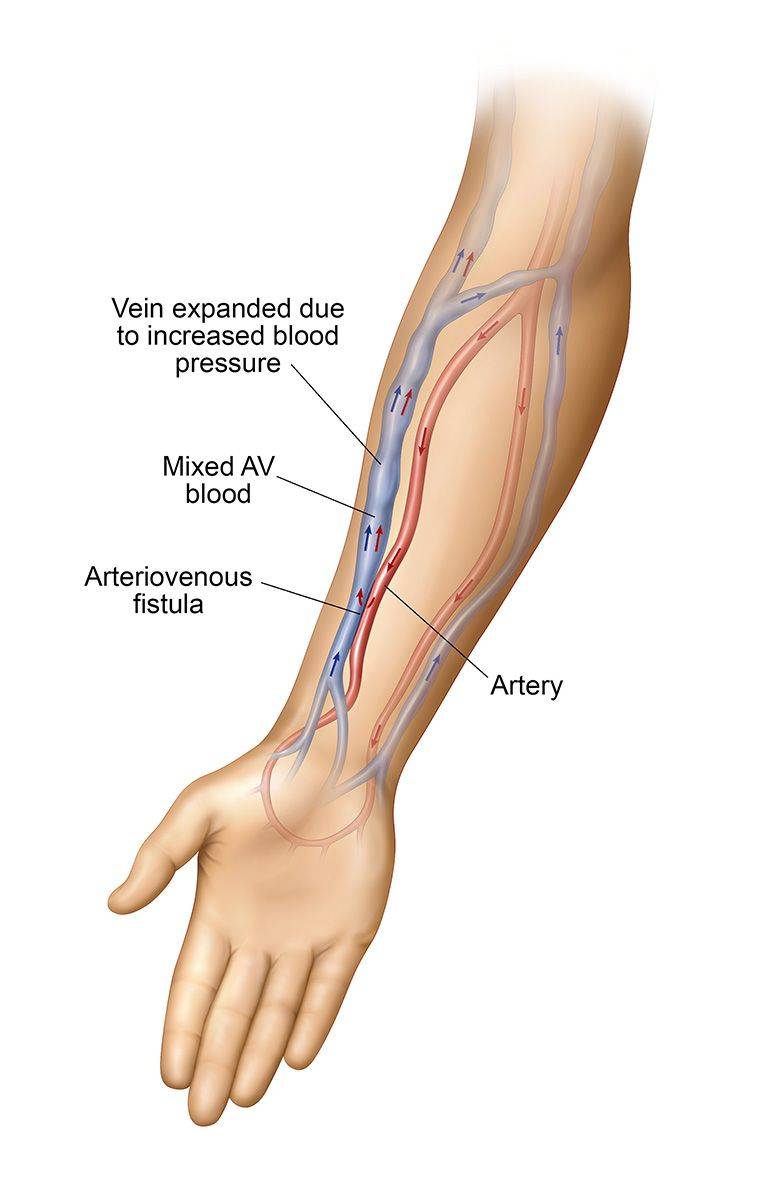 第一,很多人的手臂上已经多出来了一条血管,这条血管被称为正中动脉
