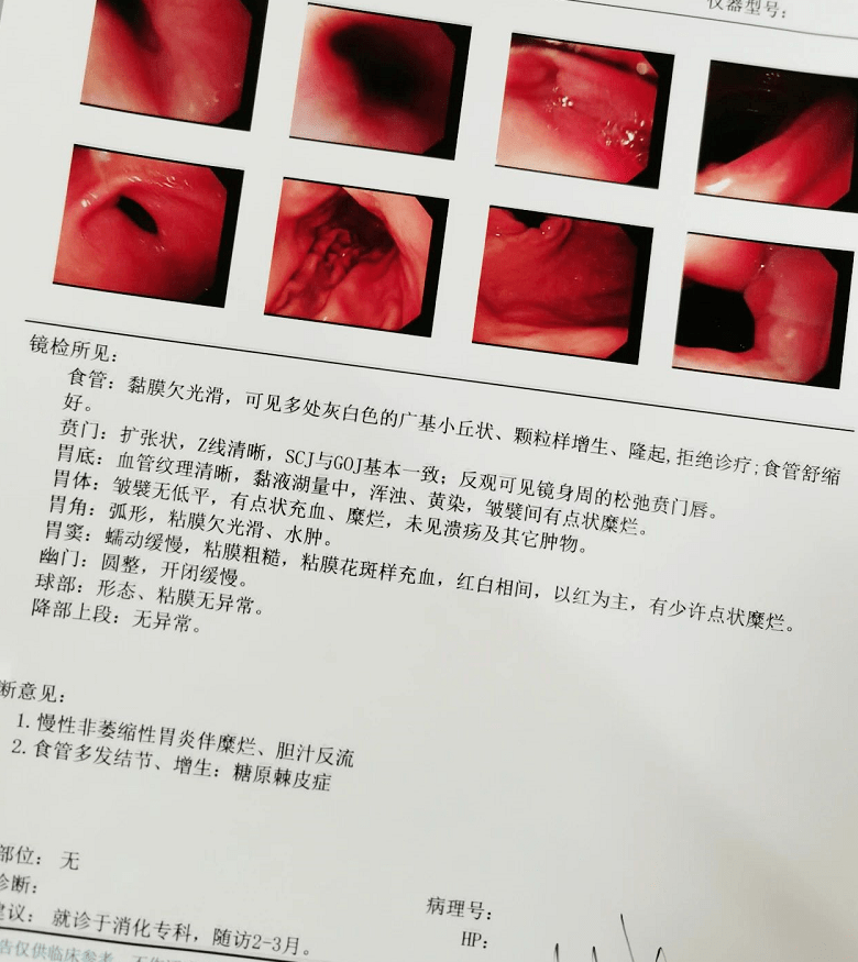 我這個問題嚴不嚴重?做完胃鏡檢查並取病理活檢後,患者最關心的一