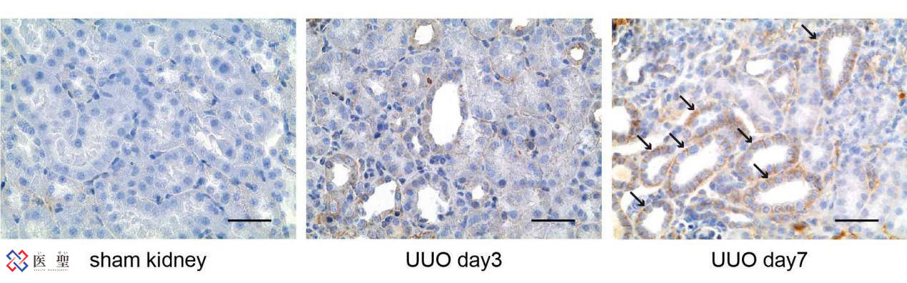 红细胞|ISEI日本干细胞—脂肪由来间充质干细胞治疗急性肾炎