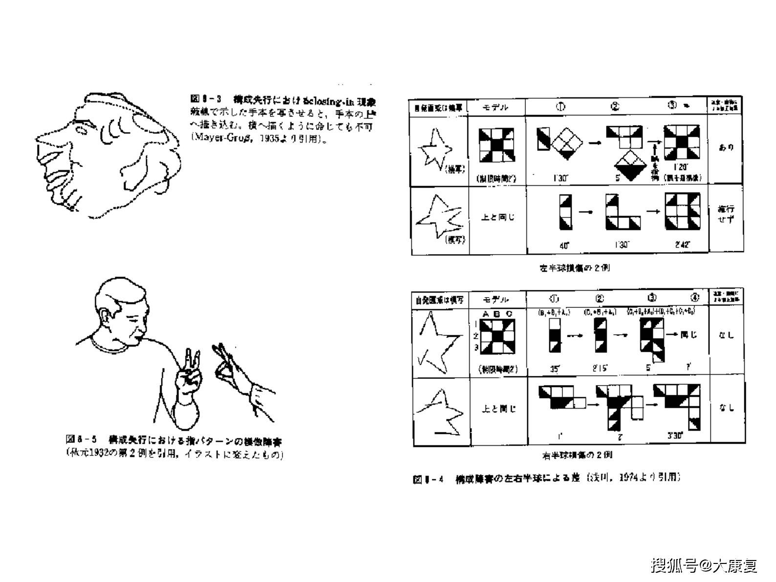 偏盲偏身感觉障碍单侧忽略失认证