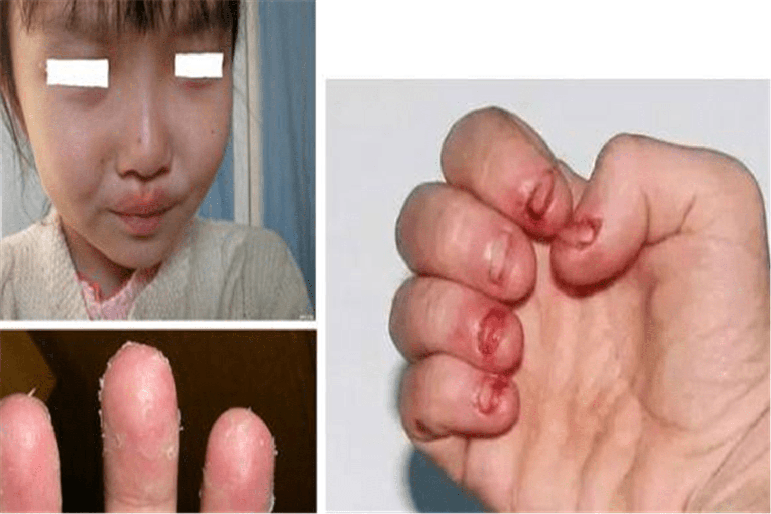 小孩咬指甲的危害照片图片