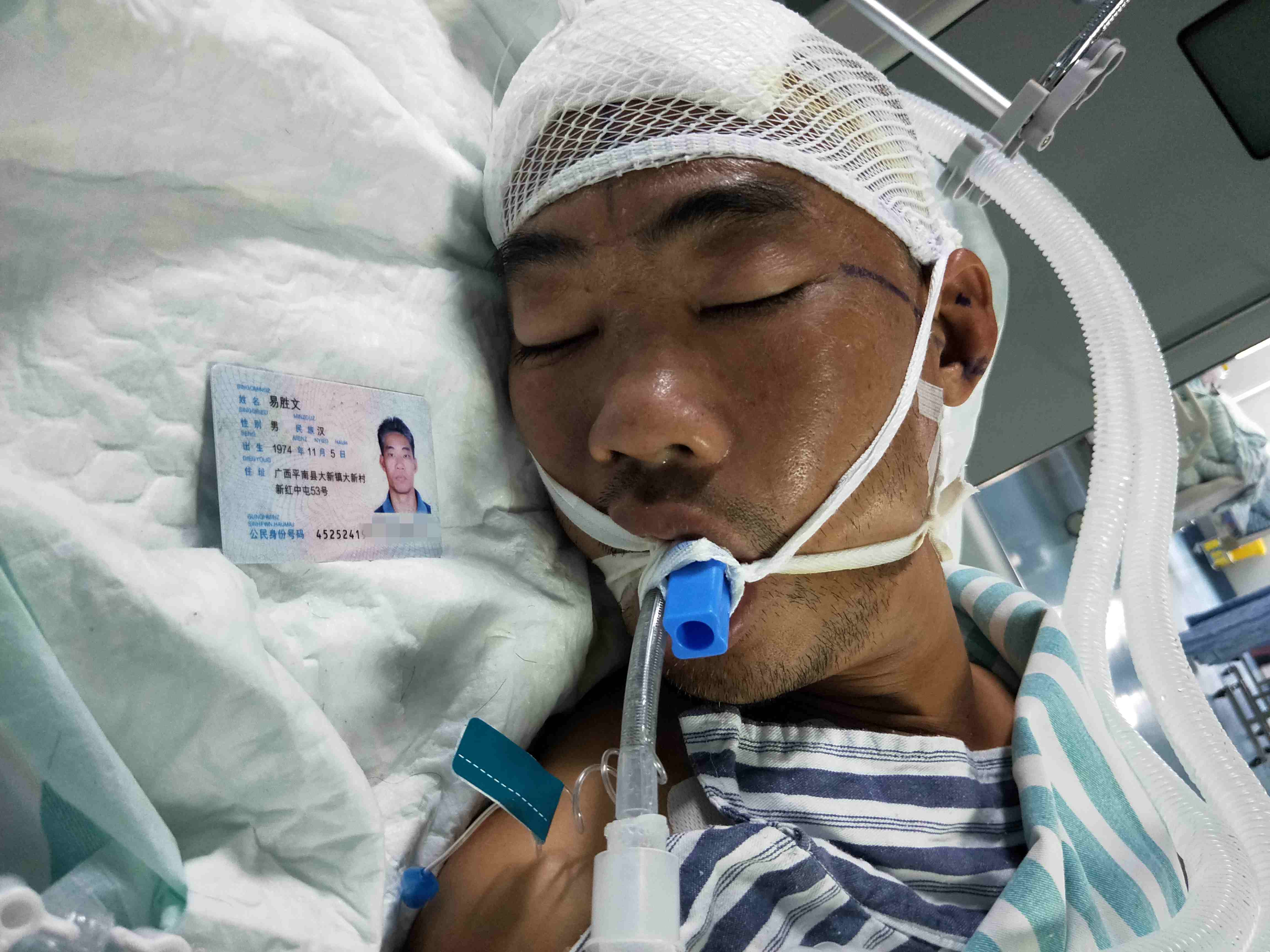 平南县46岁父亲突发脑干出血,全家人都在牵挂着父亲,恳求帮助父亲挺过