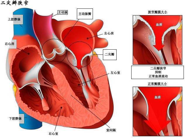 金属心脏瓣膜图片图片