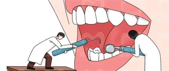 洗牙不贵为什么很多人都不洗牙