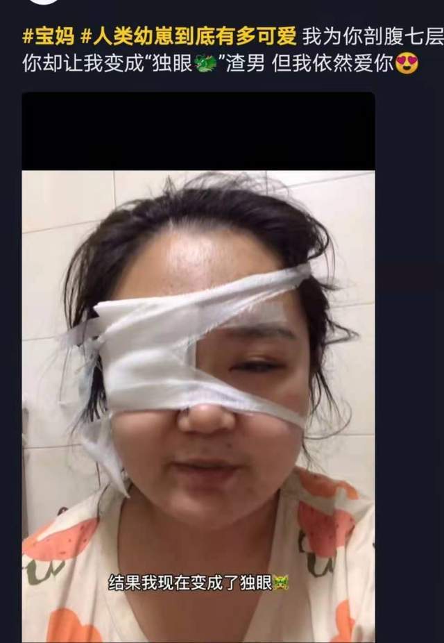 一边眼睛包着纱布,视频上面配文是:我为你剖腹七层,你却让我变独眼