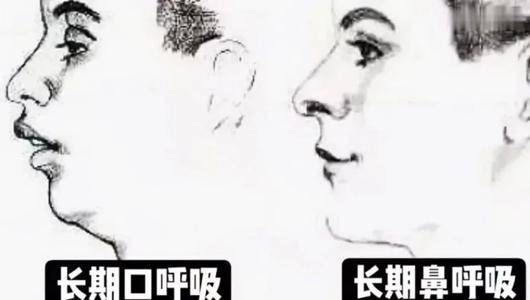 用嘴呼吸真的会变丑吗