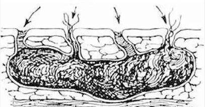为什么有些人在同房后会有尿意而有的人排尿困难
