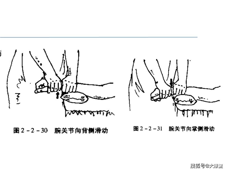 关节松动术