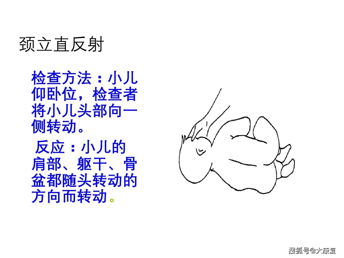 原始反射及肌张力判定