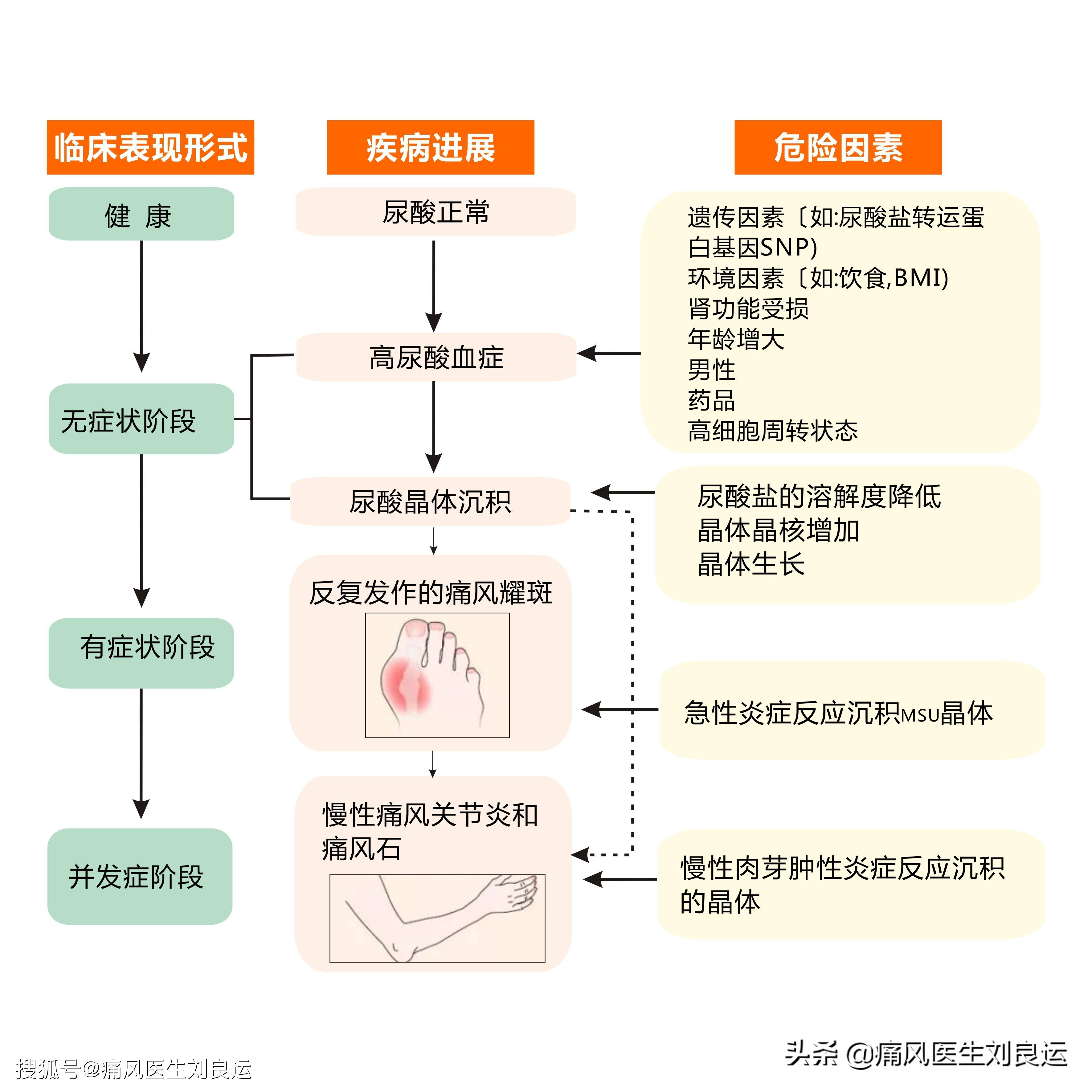 取痛风石可根治痛风?尿酸达标就能够停药?医生盘点痛风治疗误区