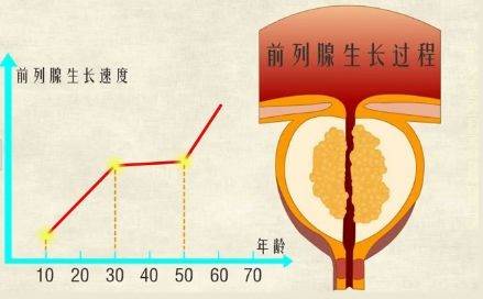 這種蔬菜是前列腺增生的