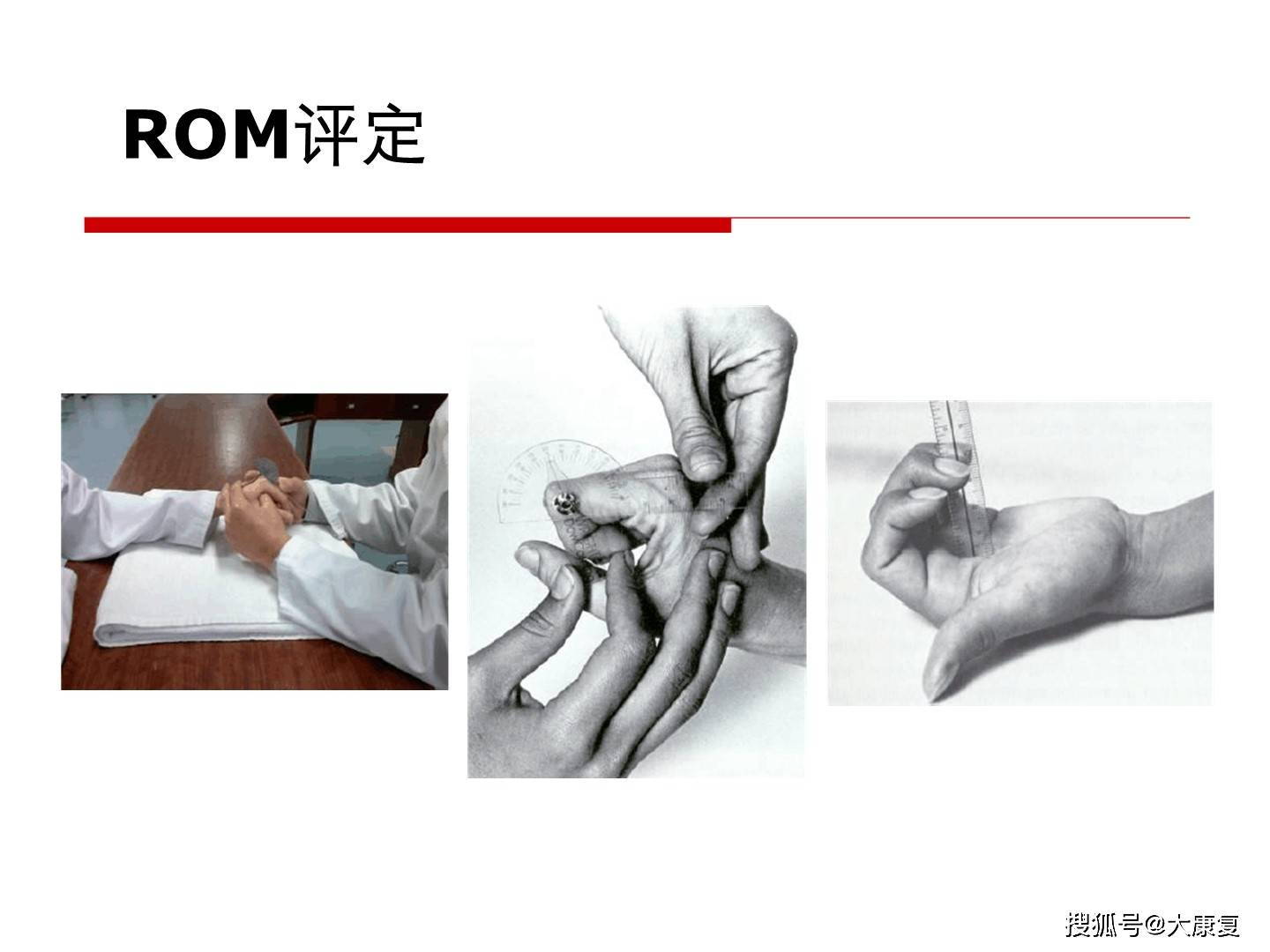 手功能障碍精准评估与治疗