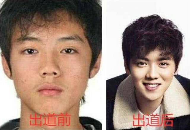 出道前vs出道后,鹿晗黄子韬逆袭,看到肖战:这是开挂了啊