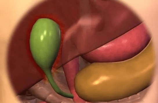 为什么长期服药的患者,易发生胆汁反流性胃炎?