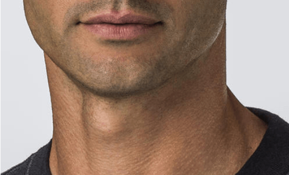 7f24a12d267b40f7b07a80c6a8f9fe4f.png